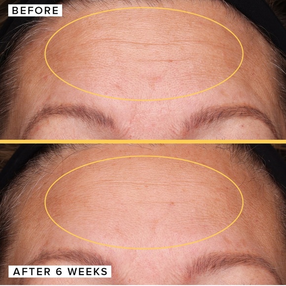 🍯 Farmacy FILLING GOOD hyaluronic acid plumping serum - Picture 5 of 11